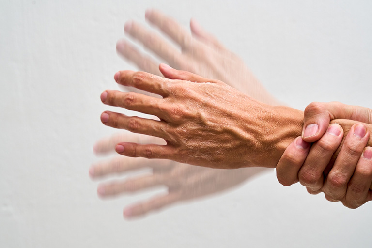 Movement Disorders Evaluation