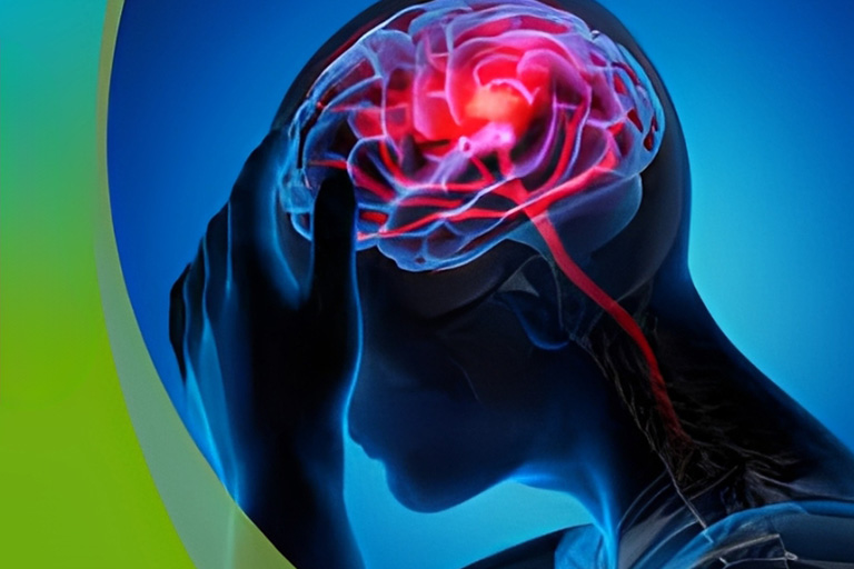 Stroke Risk Assessment & Prevention